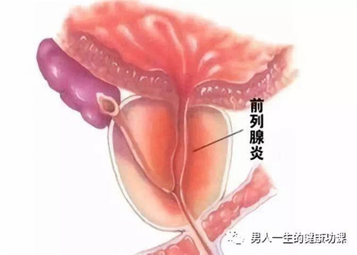 871918035299146331_副本.jpg
